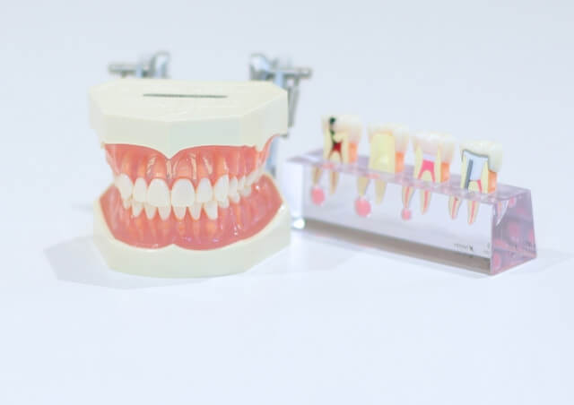 横浜市の歯科【あざみ野ポプラ歯科クリニック】で歯のトラブルを予防