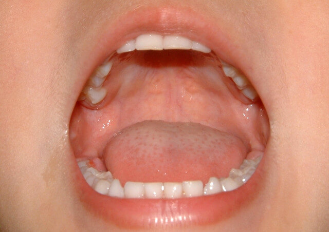 子供の歯並びが悪い…悩んだときは歯科医に相談